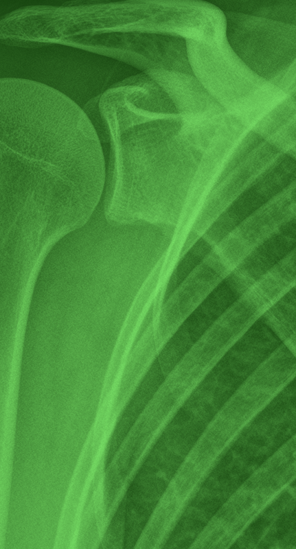 Radiographie en gros plan avec fond vert