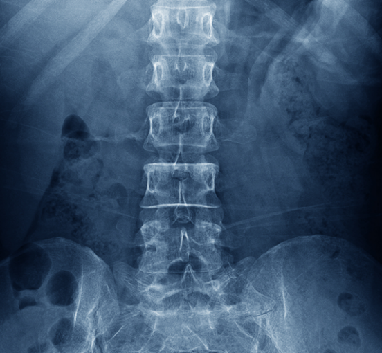 Radiographie colonne vertébrale en noir et blanc, tech care spine