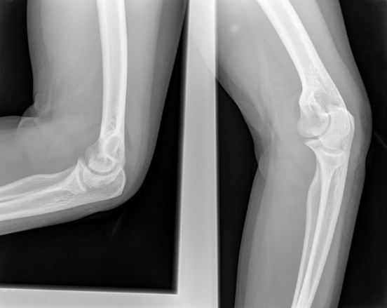 Radiographie jambes, tech care bones