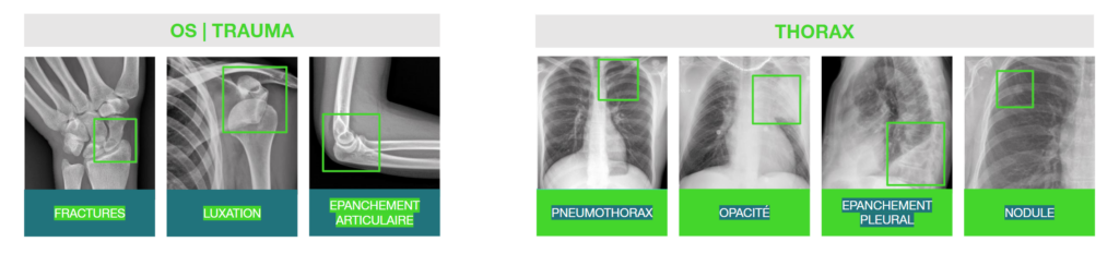 Description TechCare ALert
