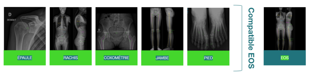 Details TechCare Bones et Spine Mesures ostéo