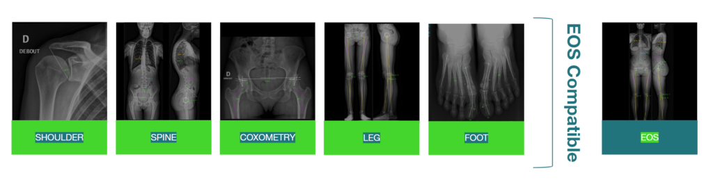 Description Bones and Spine english