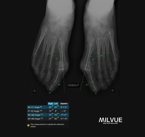 TechCare Bones
